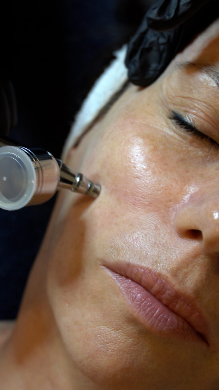 oxigenoterapia en una mujer